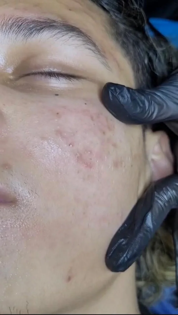 Caso 3 facial: antes